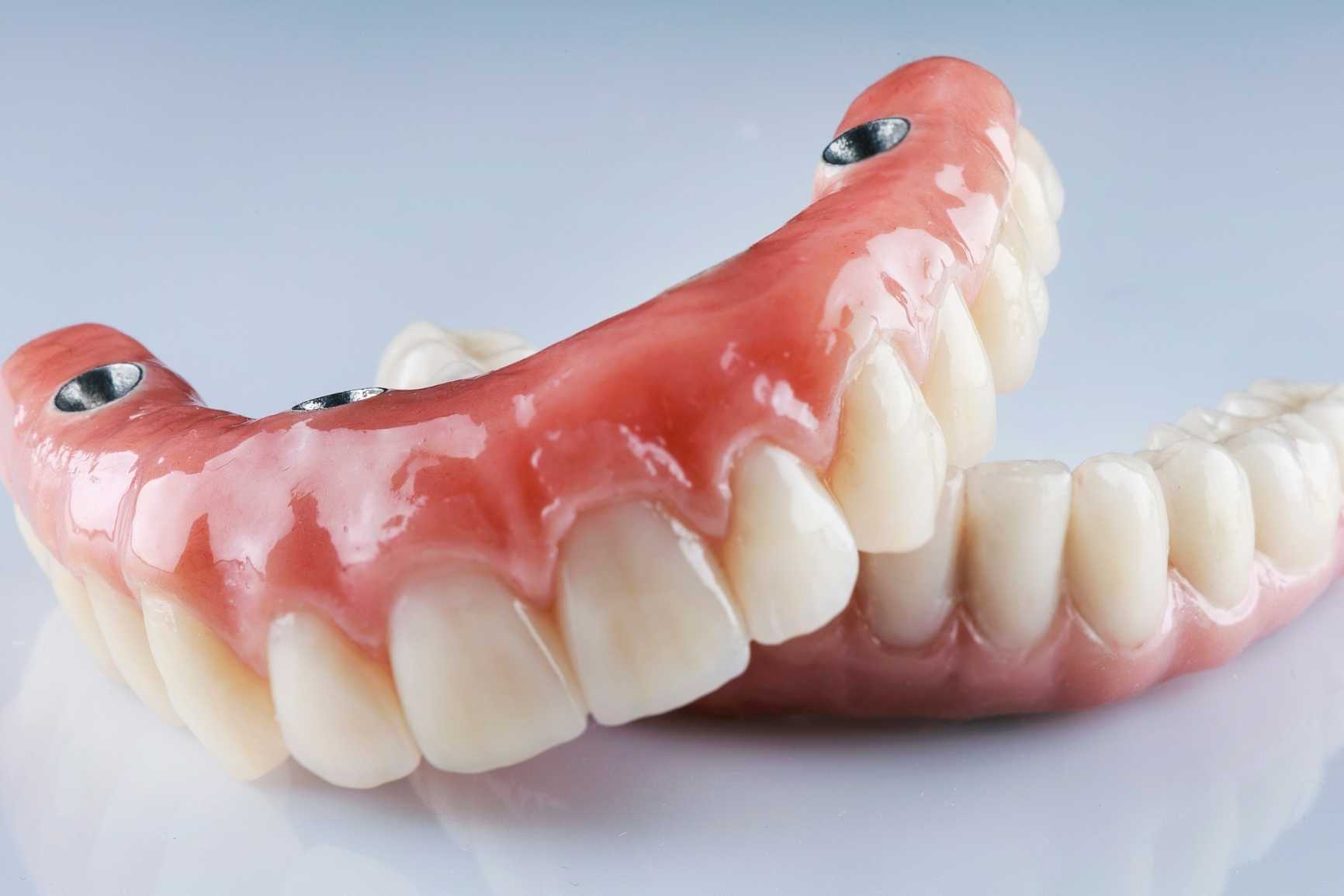 Protetik tedaviler Protetik tedaviler