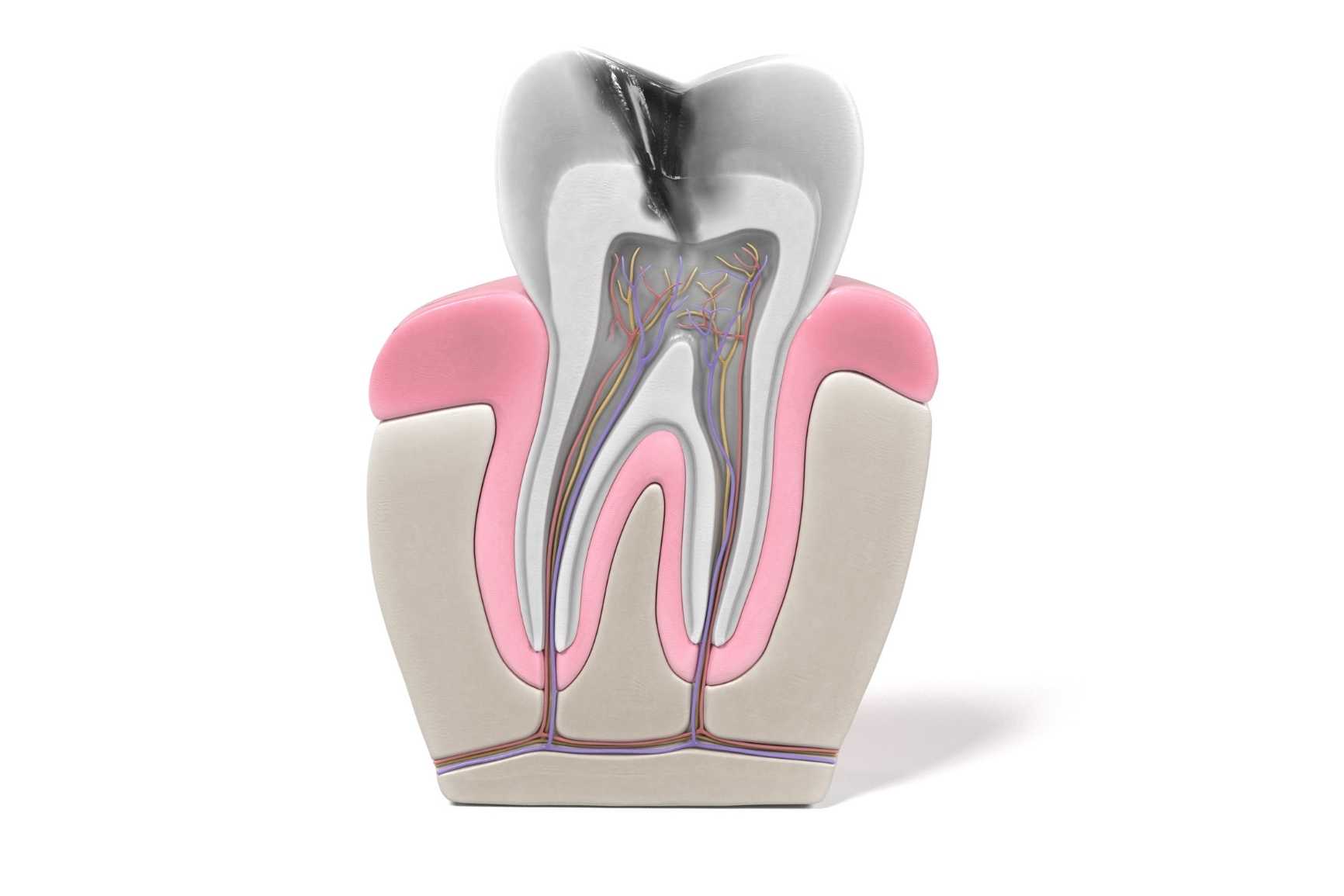 endodonti nedir?