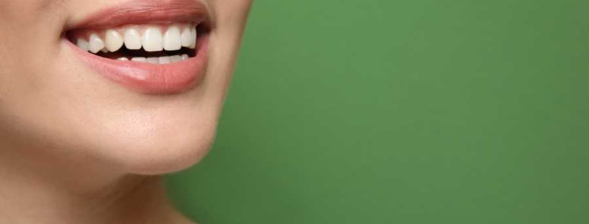 Estetik Gülüş Tasarımı