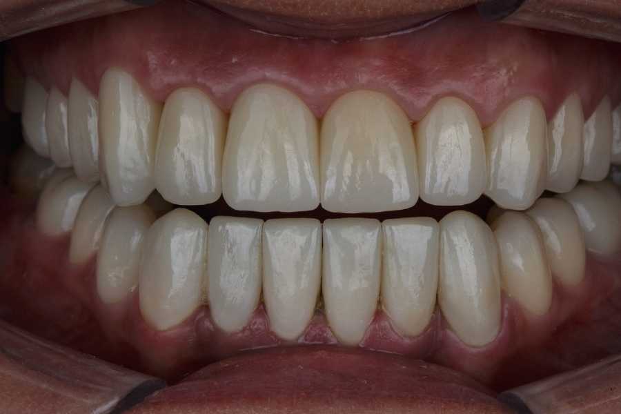 Zonguldak Ağız ve Diş Sağlığı