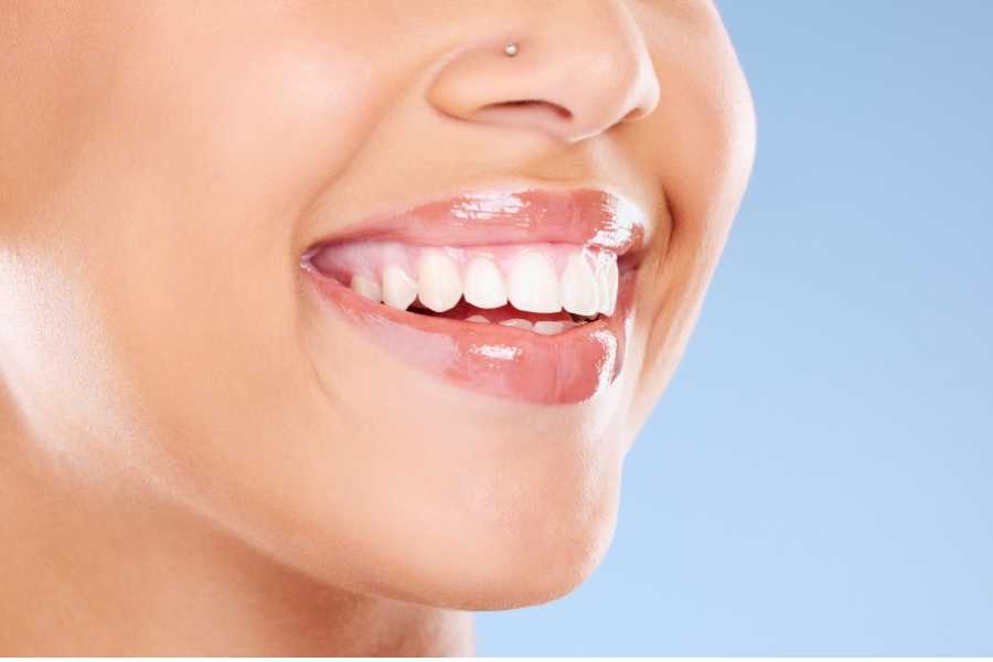 Kalıcı Diş Beyazlatma