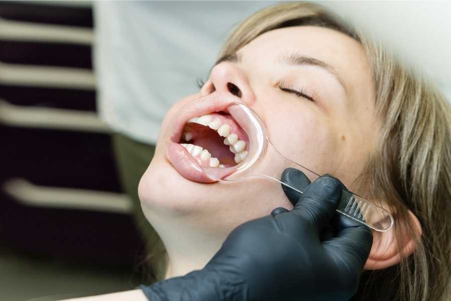 Periodontoloji ve Genel Sağlık İlişkisi